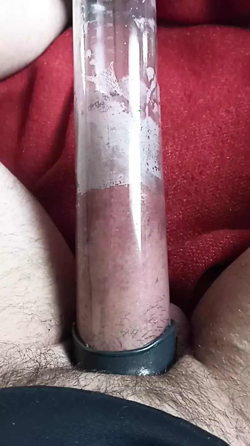 Eric S Exploded Ass Gay Pump Amateur Porn Feat Greddy Gourmande