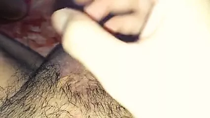 Penectomy Radical Gay Porn XHamster
