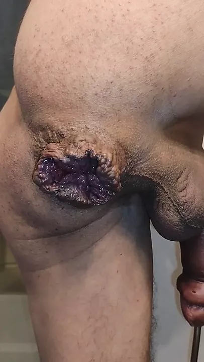 Pump Cock And Asshole Free Gay Big Cock Porn E9 XHamster