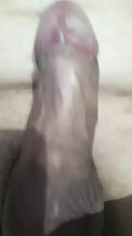 Poutsos Meta Tin Peritomi Free Man Porn XHamster