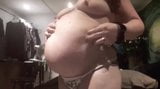 Intestino gordo se transforma em um enorme balão snapshot 6