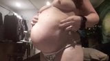 Fat gut turns into a huge balloon snapshot 6