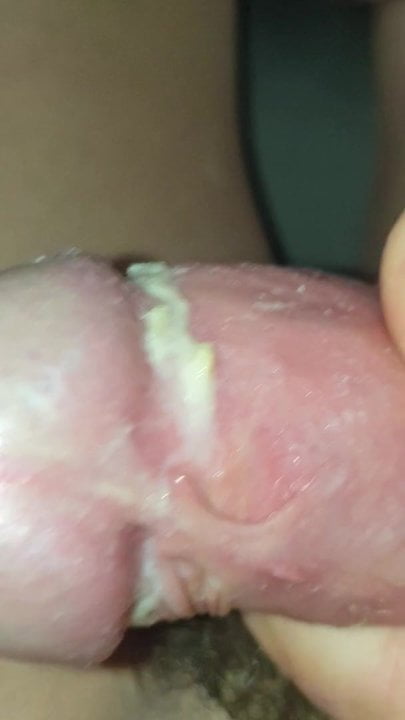 Strumpfmann Mein Smegma Schwanz: German Gay Small Cock Porn | xHamster
