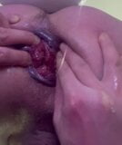 Hard Anal Gape Open Ass Prolapse snapshot 4