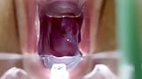 Stella St. Rose - extreme baarmoederhalsgezichten en sappen stromen met een speculum snapshot 9