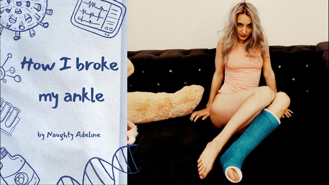 Bagaimana saya memecahkan pergelangan tangan saya, oleh Adeline yang nakal