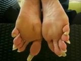 long toenails snapshot 1