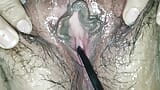 The doctor stimulates my urethra with his instruments and in the end I receive his cock in my hairy pussy snapshot 5