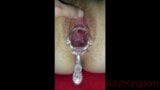 Pussy gets fisted and opened with a speculum snapshot 5