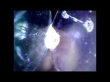 endoscope in 2 spoons push inside urethra cock exploration snapshot 12