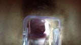 check out her cervix with speculum snapshot 9