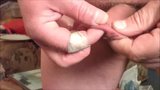 Foreskin with ice - 3 videos snapshot 14