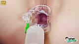 Cervical exam of chubby young blonde Cayla Lyons by 2 doctors snapshot 10