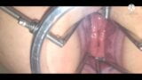 Huge Anal dilator with massive gape and nice Prolapse ending snapshot 7