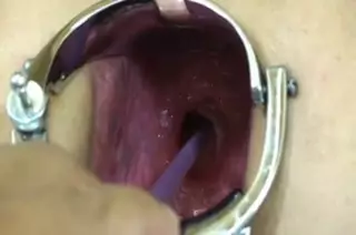 Elmer Wife Extreme Anal Speculum Play: Japanese Porn | xHamster