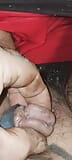 Split Gland Into Urethra With Razor Blade  By Me snapshot 3