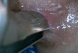 TDD11-Deep Speculum and Anal Gape snapshot 13