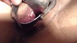 Metal speculum pussy close up snapshot 4