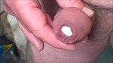 More foreskin compilations - 11 videos 33 minutes snapshot 22