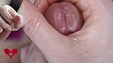 Super primer plano del glande. Juegos uretrales con el dilatador. snapshot 13