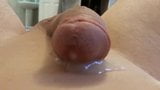 prostate play snapshot 8