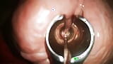 Speculum Inside My Cock Hole Made Me Cum snapshot 9