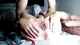 Fist Time pumped Prolapse with Penispump - Just a little off the mark :-)  - analplay snapshot 4