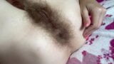 Hairy snapshot 12