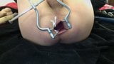 Anal Speculum 3 snapshot 13