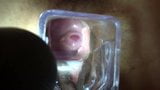 check out her cervix with speculum snapshot 8