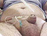 Inserting a large catheter into a small cock with big balls snapshot 3