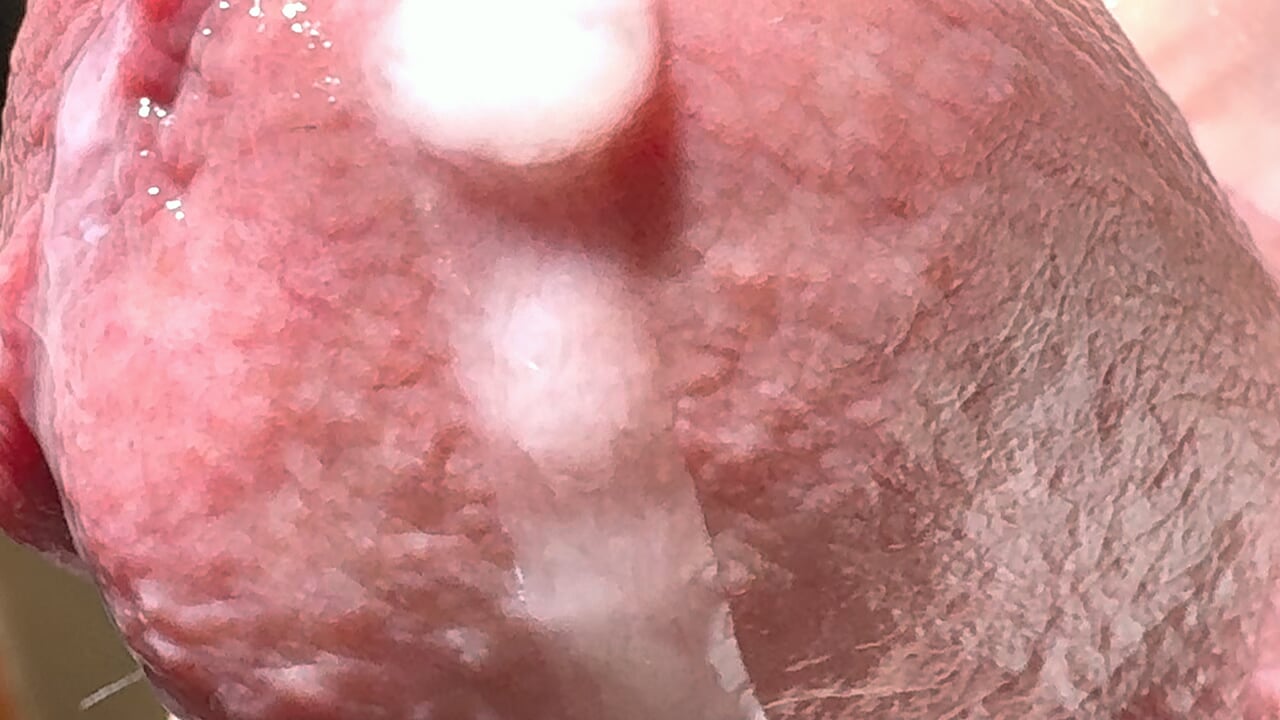 Penis Close up With German Gay Amateur Amateur Porn XHamster