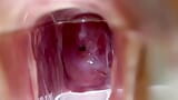 Stella St. Rose - Extreme Cervix Views and Juices Flowing Using a Speculum snapshot 12