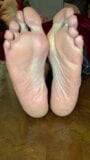 Bunion Feet snapshot 25