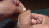 Chocolate coins (10) in foreskin snapshot 4
