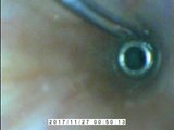 Endoscope E-stim inside Cumming.AVI snapshot 15