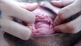 Pervert Files: 18yo Prolapsed Hairy Cunt Meat snapshot 8