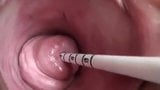 Masturbation uterus snapshot 2