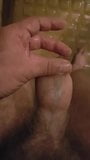 foreskin urine inflation snapshot 10