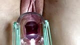 Stella St. Rose - extreme baarmoederhalsgezichten en sappen stromen met een speculum snapshot 6