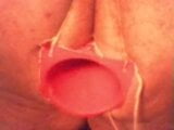 Old Anal stretching  clip (plastic cone) snapshot 4