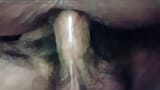 The doctor stimulates my urethra with his instruments and in the end I receive his cock in my hairy pussy snapshot 17