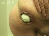 prolapse Large anal fist insertion extreme stretch weird snapshot 6