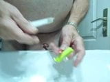 udo 333 Urethra dehnen an penectomy snapshot 2