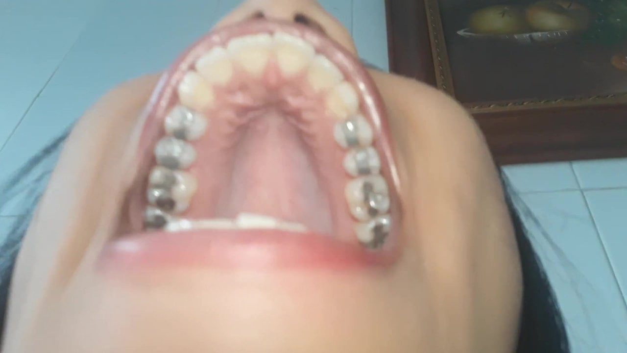 Silver filling fetish