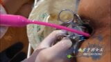 Schöner weiblicher Chirurg mit dem Fisting der chirurgischen Handschuhe snapshot 13