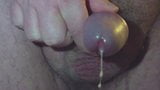 Fluxo de esperma da próstata snapshot 2