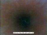 Inside my peehole snapshot 2