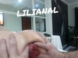 Prolapso anal snapshot 2