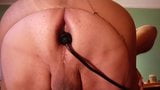 Anal pumping and propolase snapshot 2